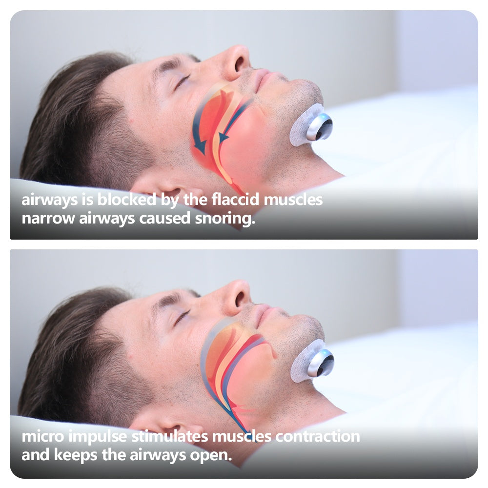 Smart Anti Snoring Device Electronic Muscle